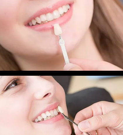 cosmetic dentistry image